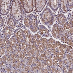 ZNF749 Antibody, Novus Biologicals:Antibodies:Primary Antibodies